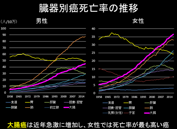 大腸がんで命取りにならないために～定期的な大腸カメラとポリープ切除を～