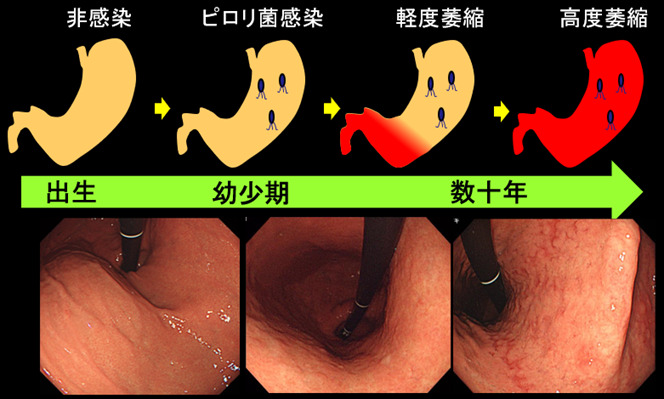 症状